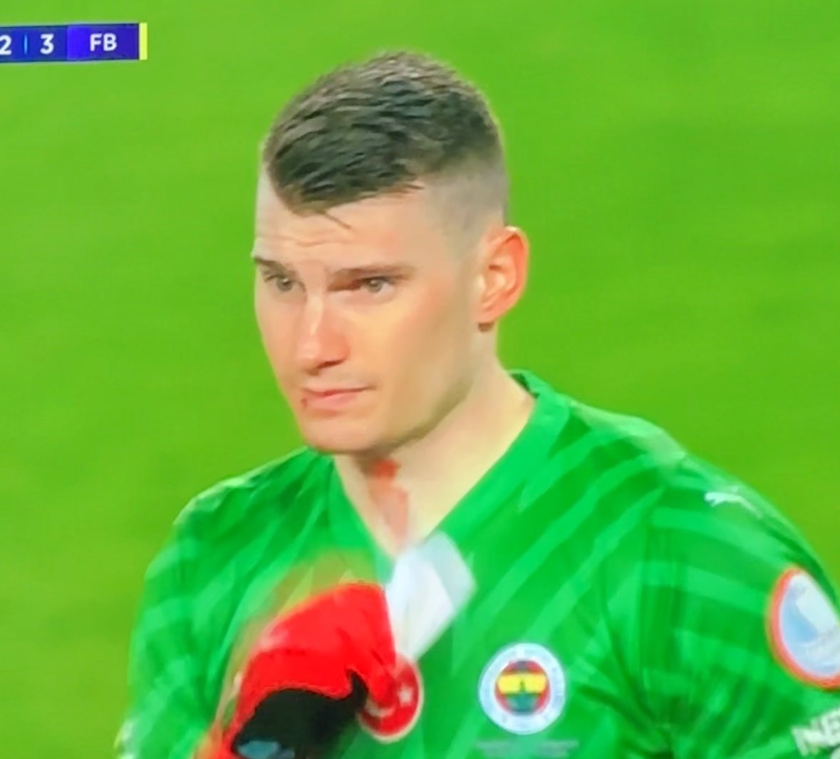 Şurda hepiniz Türkiye'de bunlar normal diyip geçiştirmiştiniz iki yüzlü hainler