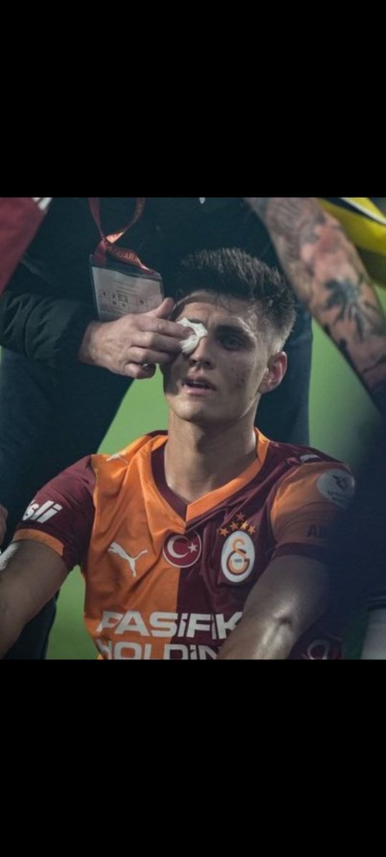 Fenerbahçe seyircileri tarafından atılan madde ile Kazımcan Karataş az daha gözünü kaybedecekti. Hiç bir Fenerbahçeli yönetici ve futbolcu maçtan sonra geçmiş olsun açıklaması yapmadı. Fenerbahçe nin sahası en az 5 maç kapanmalı...#GSvFB