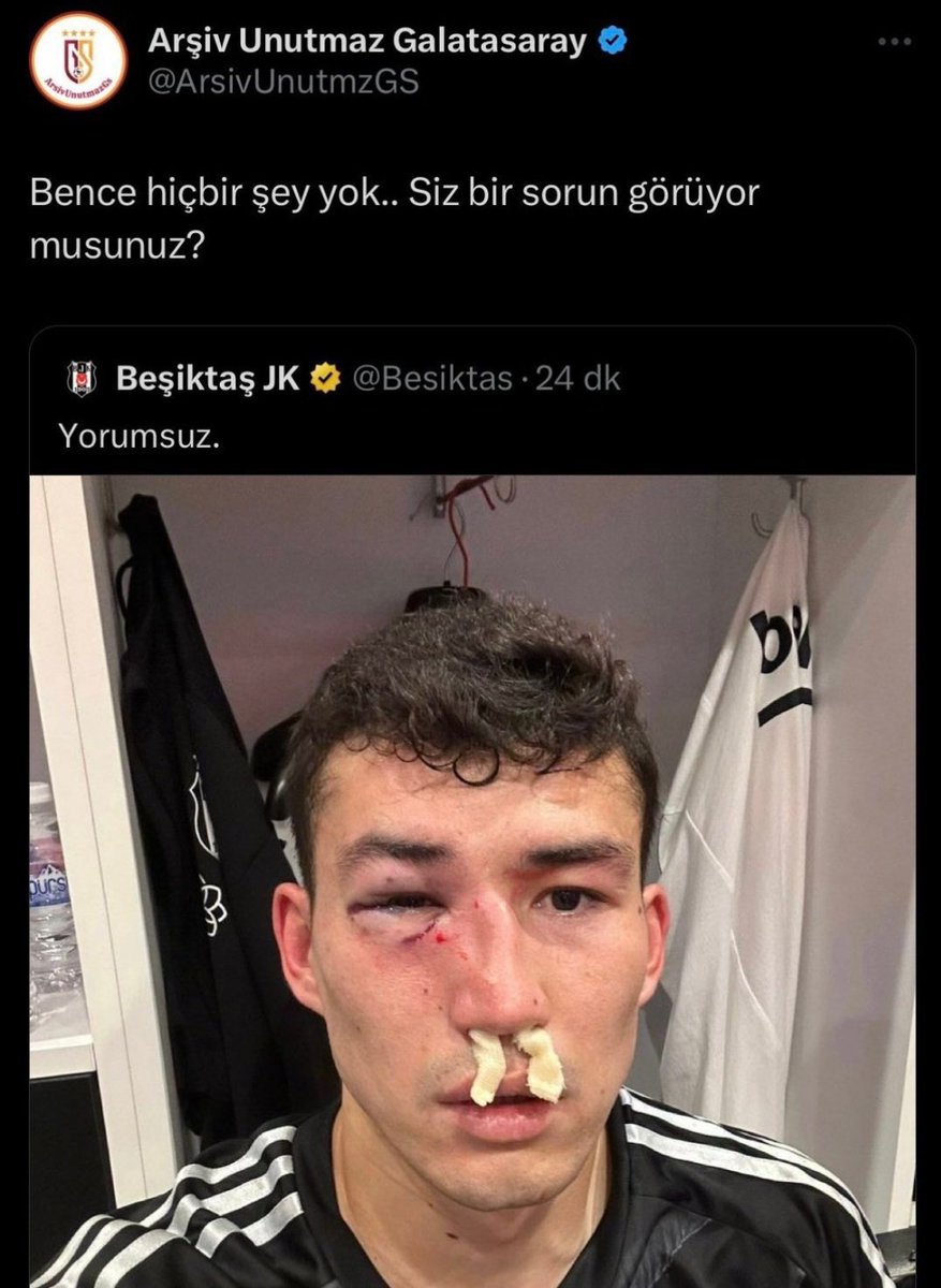 Sizin anladığınız dilden tepkimiz budur