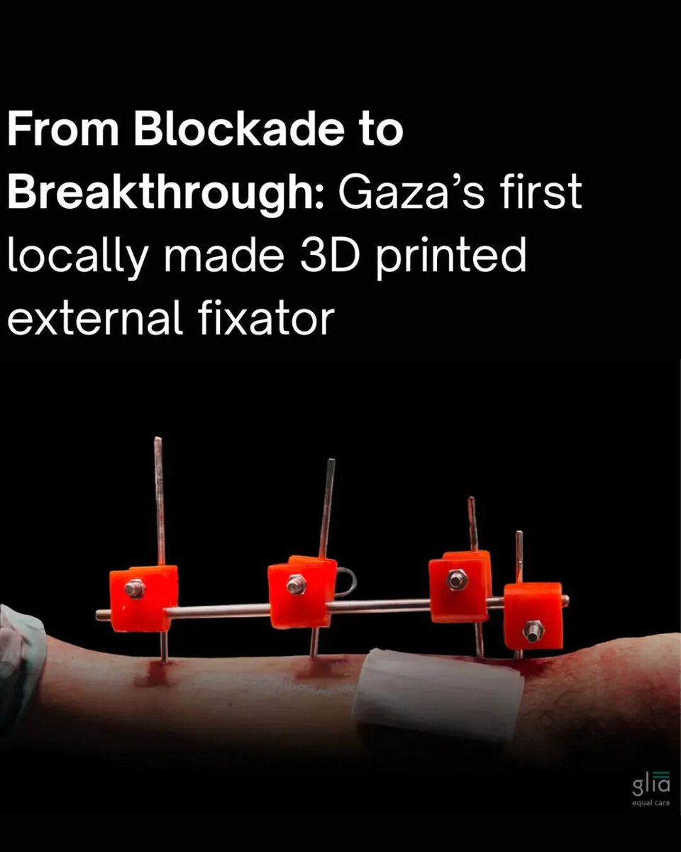 translatingpal's tweet image. ‼️Palestinian doctors and engineers have built the first-ever 3D-printed external fixator entirely inside Gaza, using recycled materials and solar power amidst an ongoing genocide and blockade.

This device, now saving lives and preventing amputations, is a testament to…
