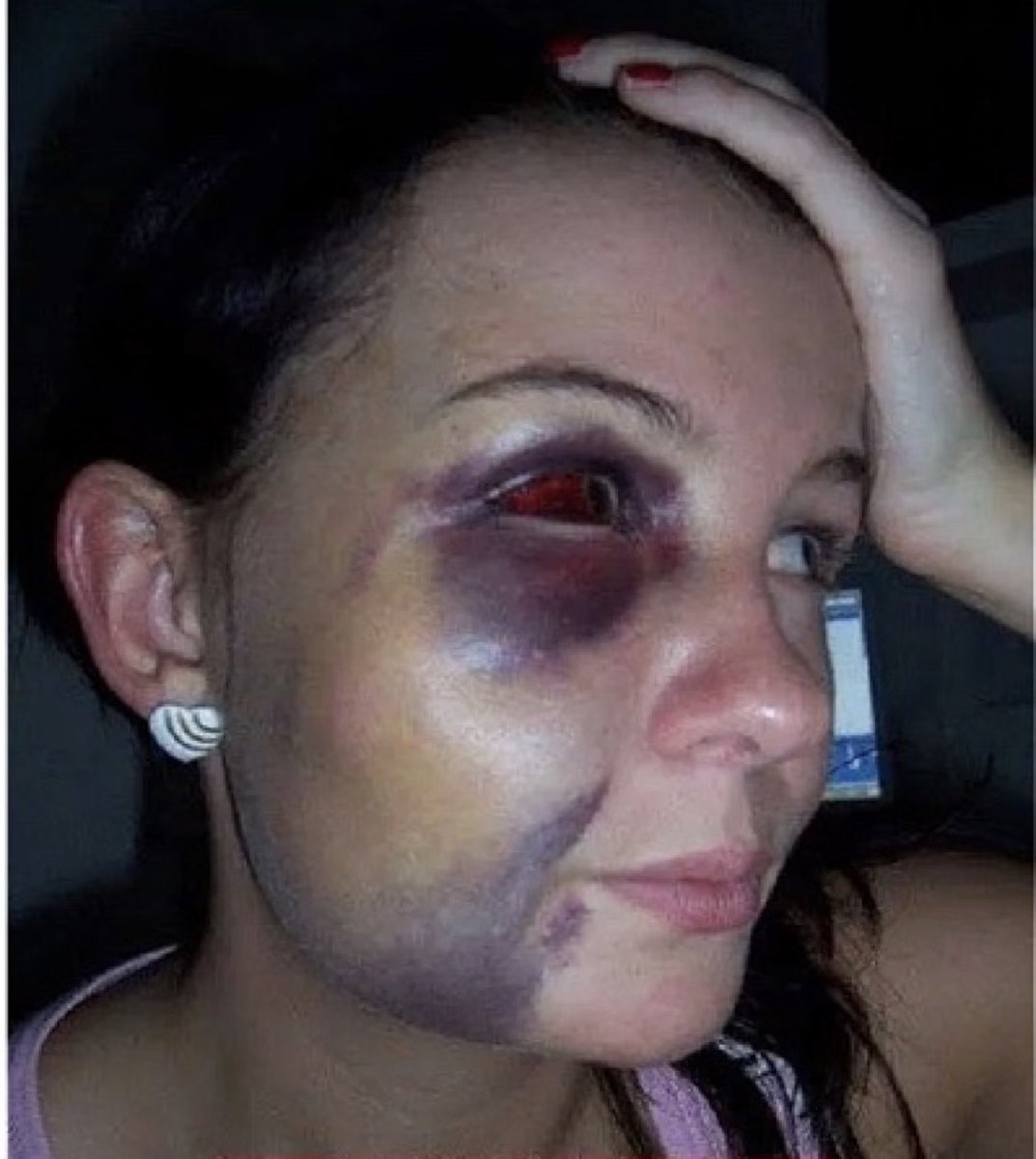 This is what <a href="/keithellison/">Keith Ellison</a> does to his girlfriends.

He calls it attitude adjusting.