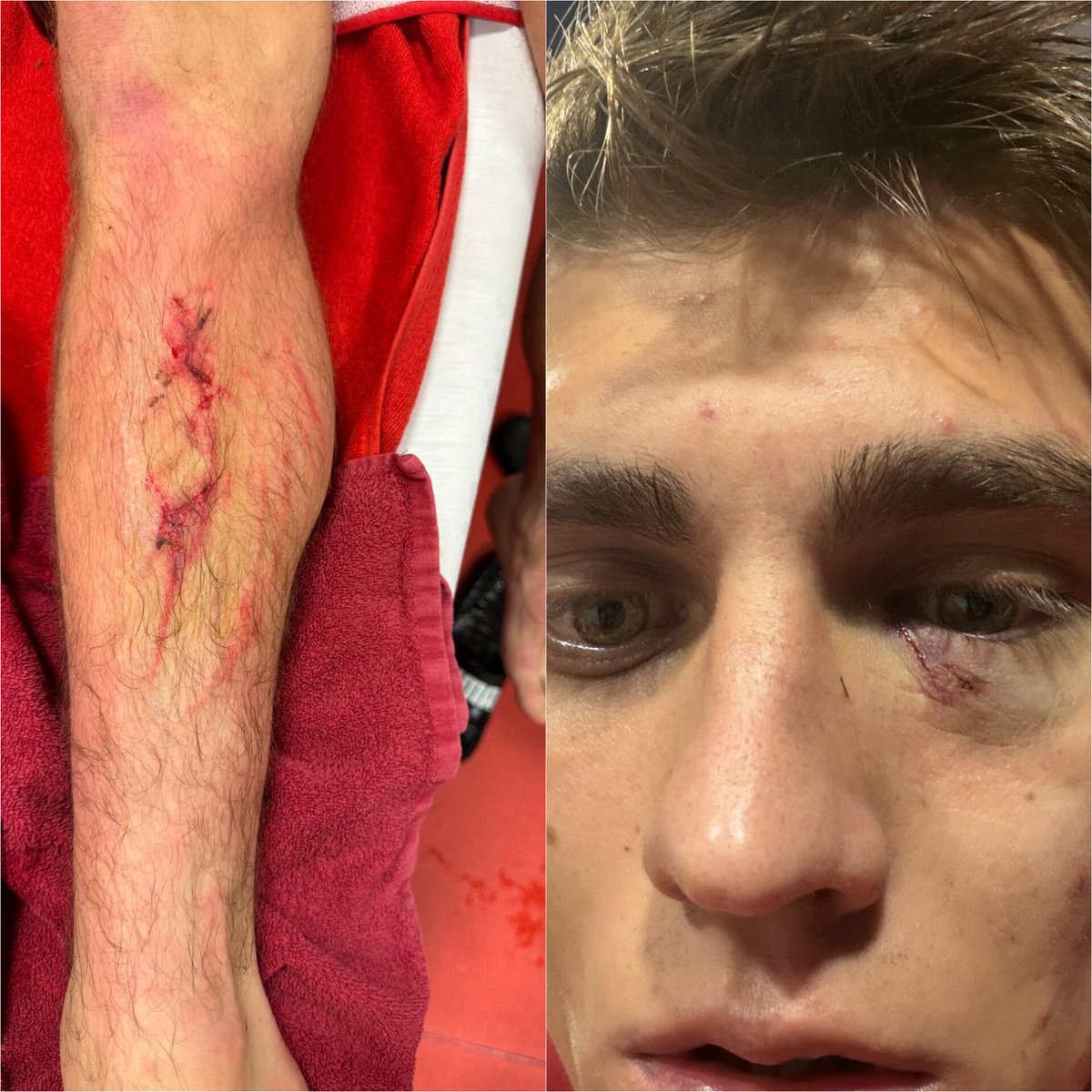 Son bir haftada Galatasaray oyuncularına yapılan müdahaleler.

🔸 Roland Sallai'ye yapılan sert faul (kırmızı kart gösterilmedi).
🔸 Kazımcan Karataş'a Chobani'de yapılan saldırı.