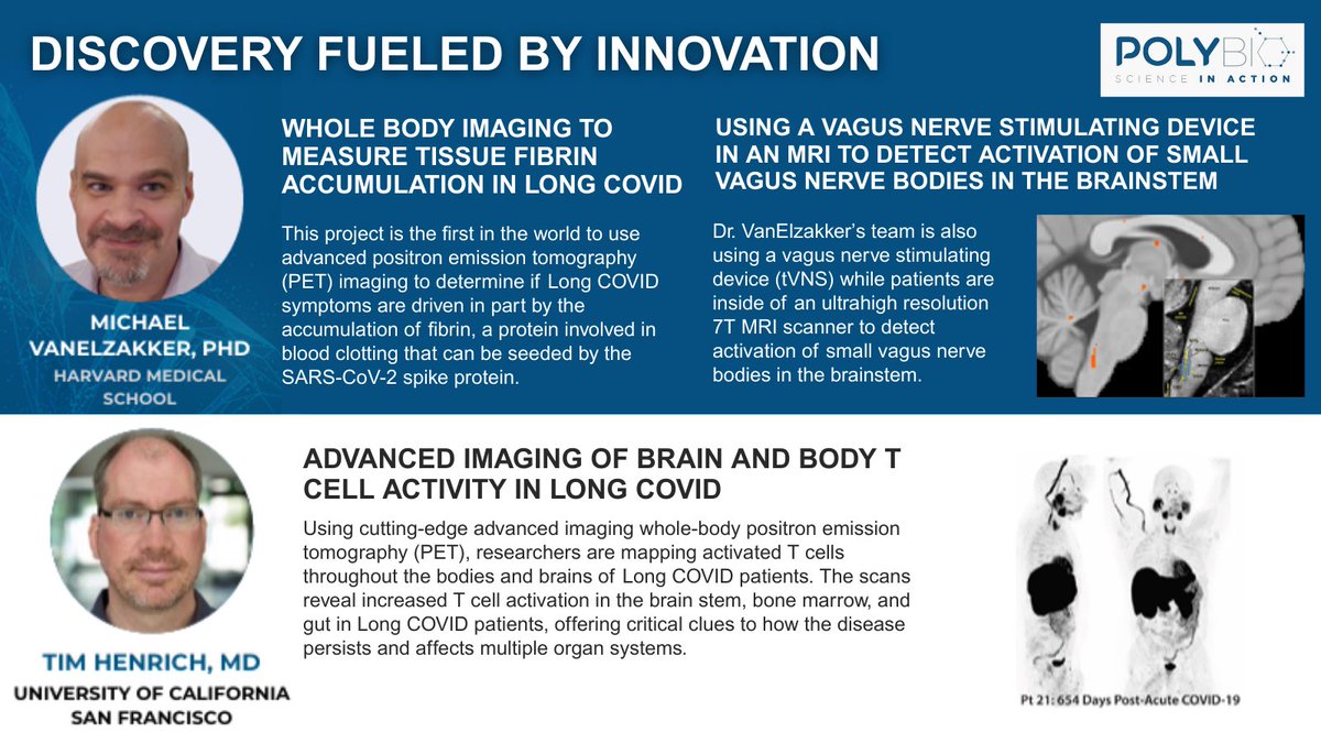 polybioRF's tweet image. PolyBio is helping develop and deploy new technologies to determine the drivers of Long Covid. We’re supporting countless cutting-edge studies—including a PET-MRI study at Harvard Medical School, investigating fibrin accumulation in patients’ bodies.