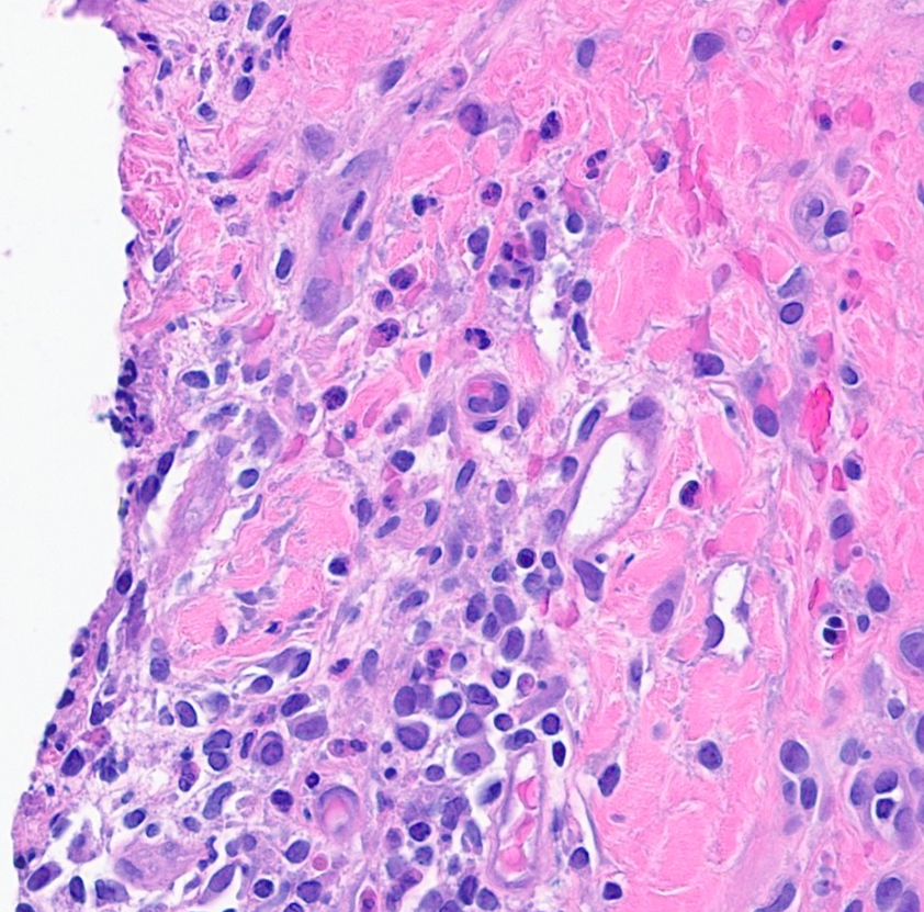 A. Sarah Erem tweet media