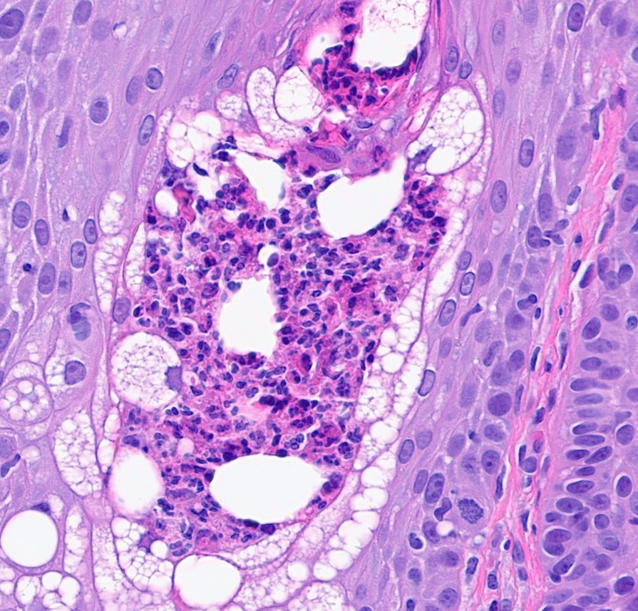 A. Sarah Erem tweet media