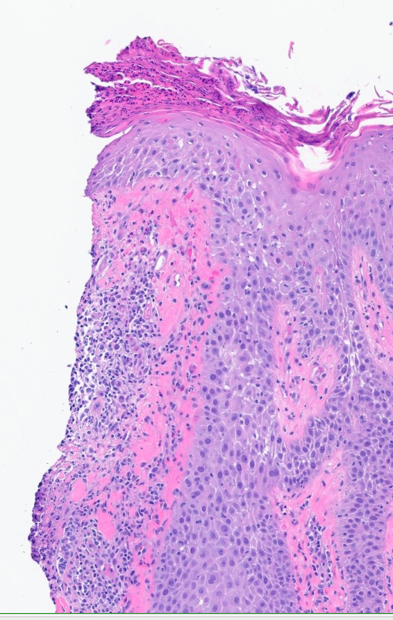 A. Sarah Erem tweet media