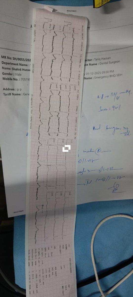 cmobaramulla's tweet photo. A patient (driver of Hon'ble MLA) reported to CHC Uri with chest pain, and ECG confirmed IWMI. Thrombolysis with Tenecteplase was successfully performed. The patient was stabilized post-thrombolysis and referred to SKIMS Soura in 108, in presence of the Hon'ble MLA.@SyedAbidShah https://t.co/RGZHAIN2b9