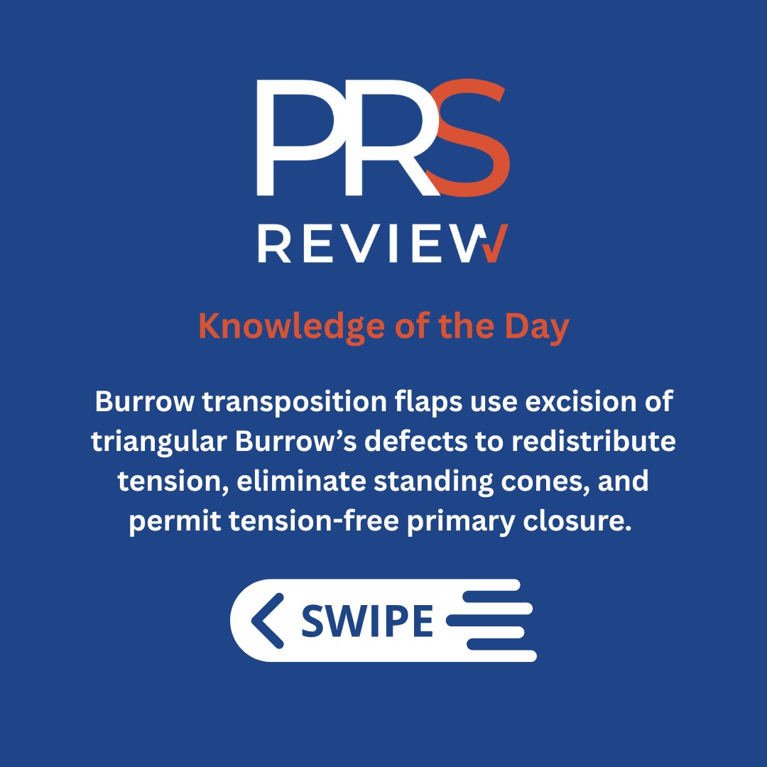 prsreview's tweet image. Single-tangent Burrow flap

#prsreview #mohs #flap #mohsreconstruction #dermatology #burrowflap #burrowtriangle #localflap #facialreconstruction #cancer #skincancer #microsurgery #plasticsurgery #reconstructivesurgery #surgicaleducation #medicaleducation #meded #surgery