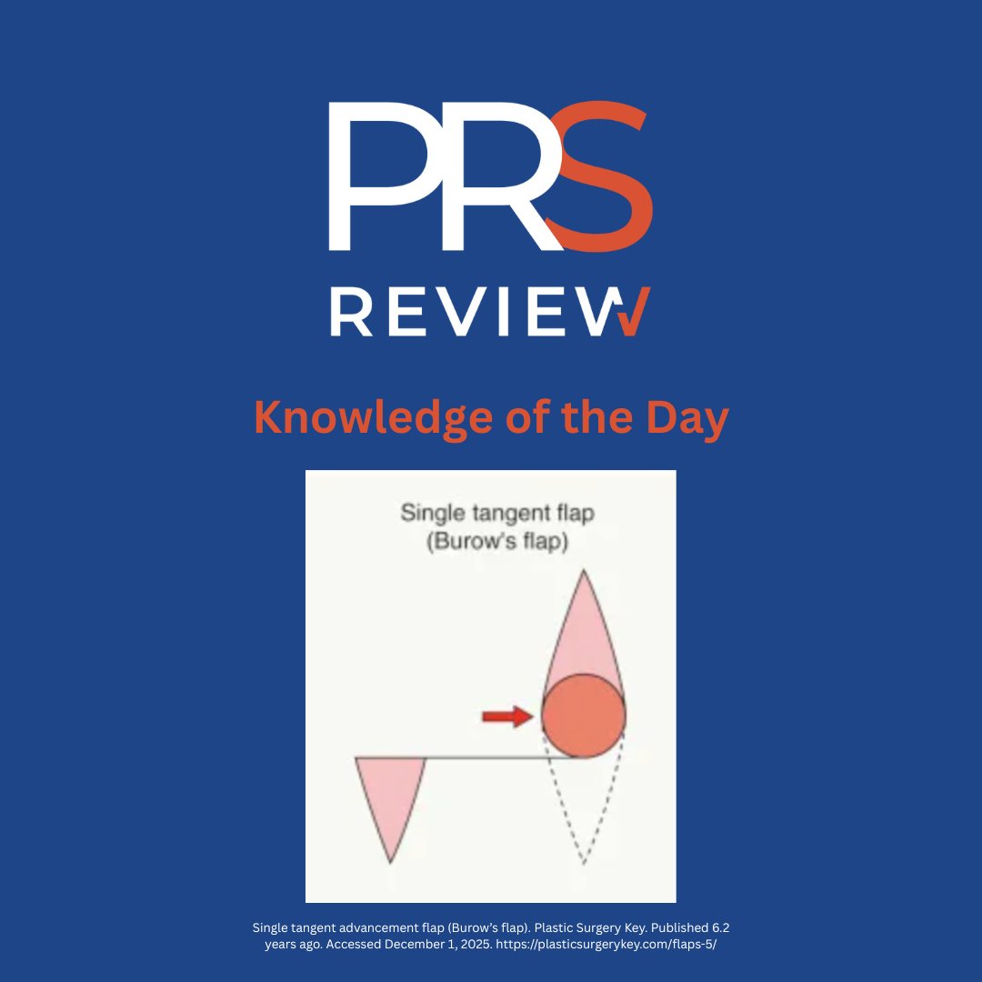 prsreview's tweet image. Single-tangent Burrow flap

#prsreview #mohs #flap #mohsreconstruction #dermatology #burrowflap #burrowtriangle #localflap #facialreconstruction #cancer #skincancer #microsurgery #plasticsurgery #reconstructivesurgery #surgicaleducation #medicaleducation #meded #surgery