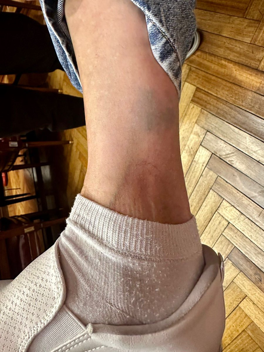 WalterVuotoTDF's tweet image. Expreso mi más enérgico repudio a los gravísimos hechos ocurridos en el Senado de la Nación, que incluyeron agresiones físicas y acciones inaceptables contra la senadora fueguina Cristina López.

El ingreso irregular al despacho de una senadora, el cambio de cerraduras, el fajado…