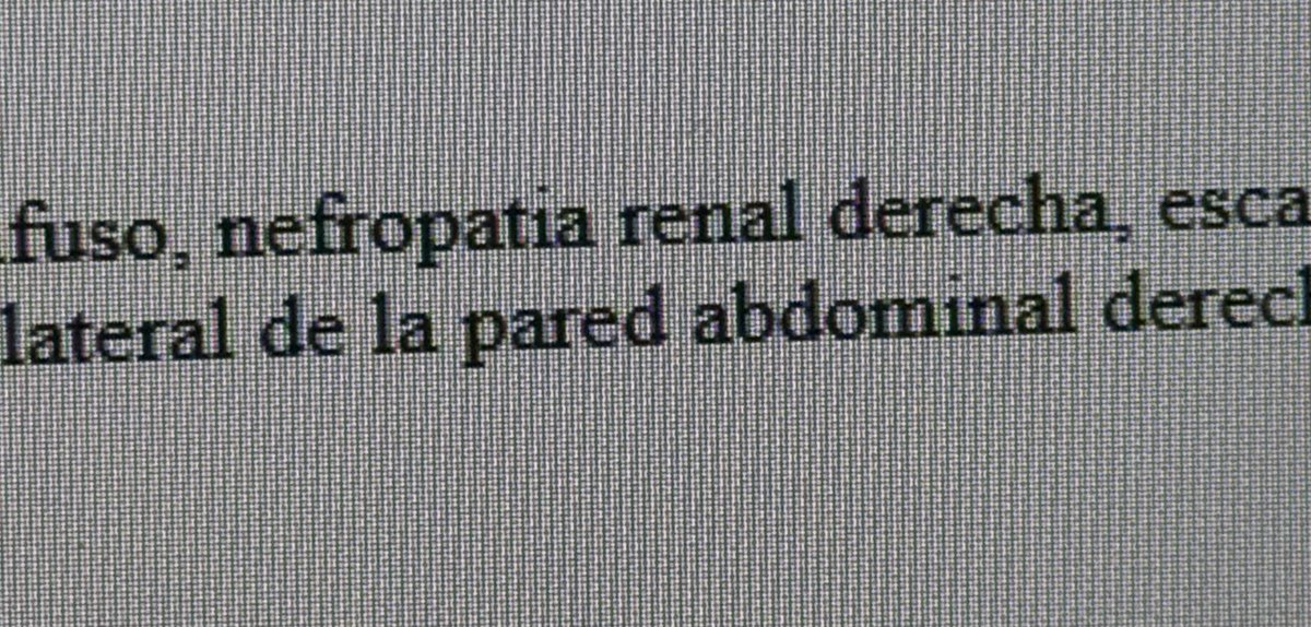 AcidoRinon's tweet photo. Eso mamona. El límite es el cielo.

Nefropatia renal https://t.co/dnepN2qlCI