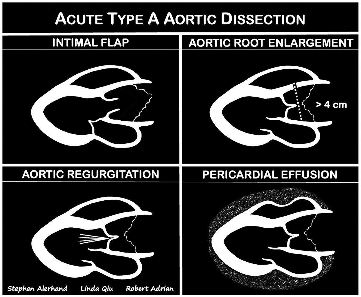NephroPOCUS tweet media