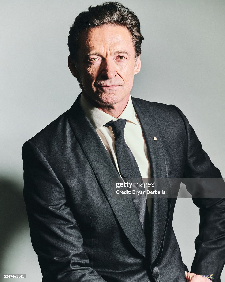 The lighting and the editing did him dirty!! They need to fire this photographer's ass ASAP!!