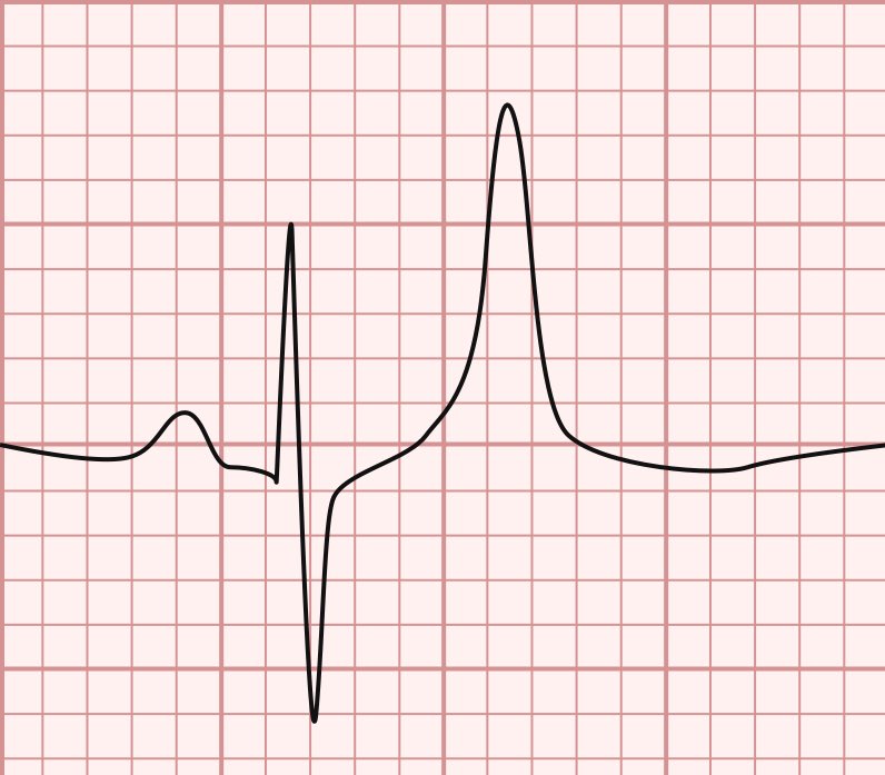 DrPharmDMDTh's tweet image. 1. Diagnosis? 

2. Treatment ?