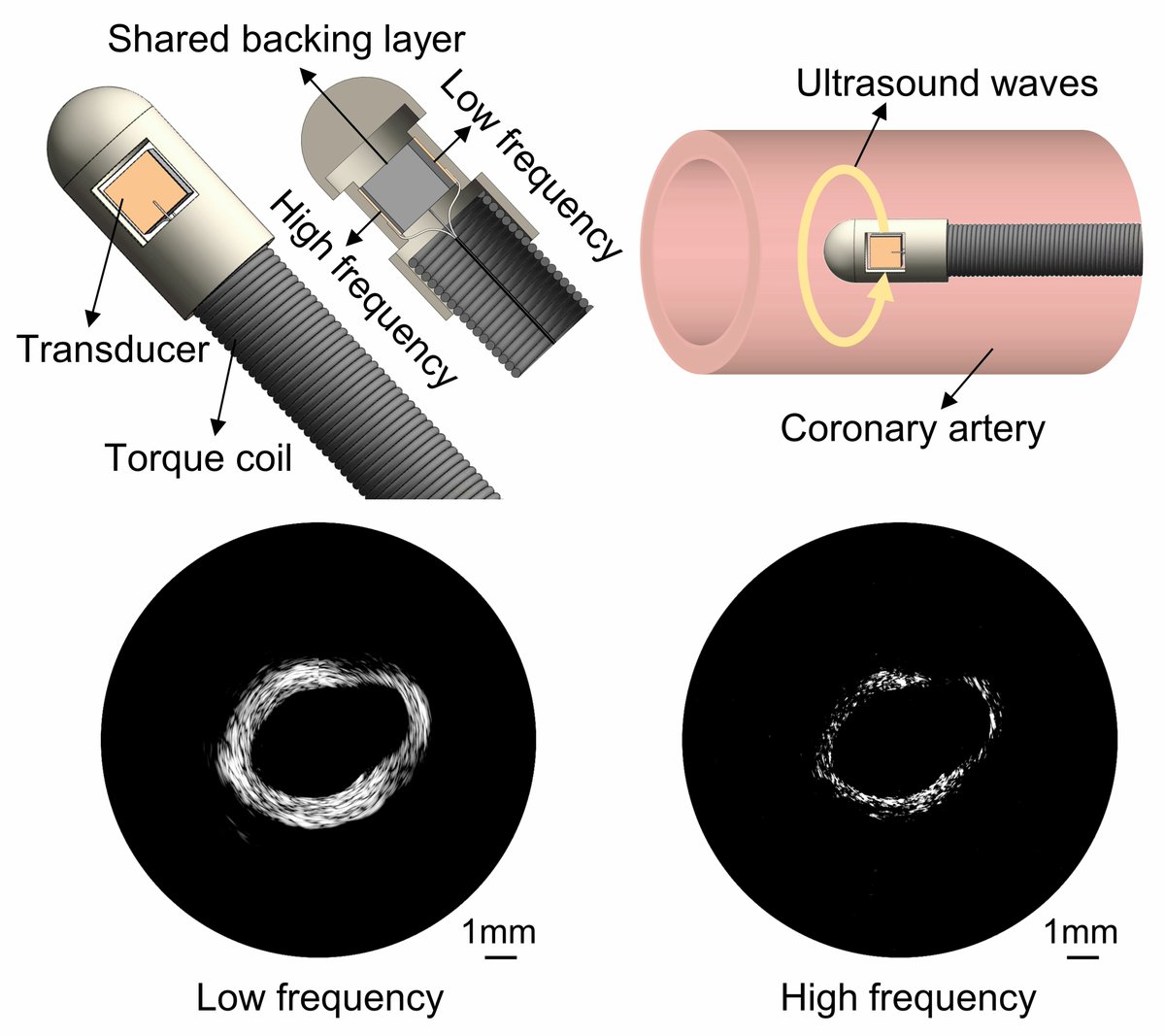 Biosensors_MDPI's tweet photo. 📣Call for Reading:
#Article
A Backing-Layer-Shared Miniature Dual-Frequency Ultrasound Probe for Intravascular Ultrasound Imaging: In Vitro and Ex Vivo Validations
by Yashuo He, et al.
https://t.co/hRNLVB9ITn
#DualFrequency #ultrasound #imaging
#biosensors #mdpi #openaccess https://t.co/bBgIGXaRsw