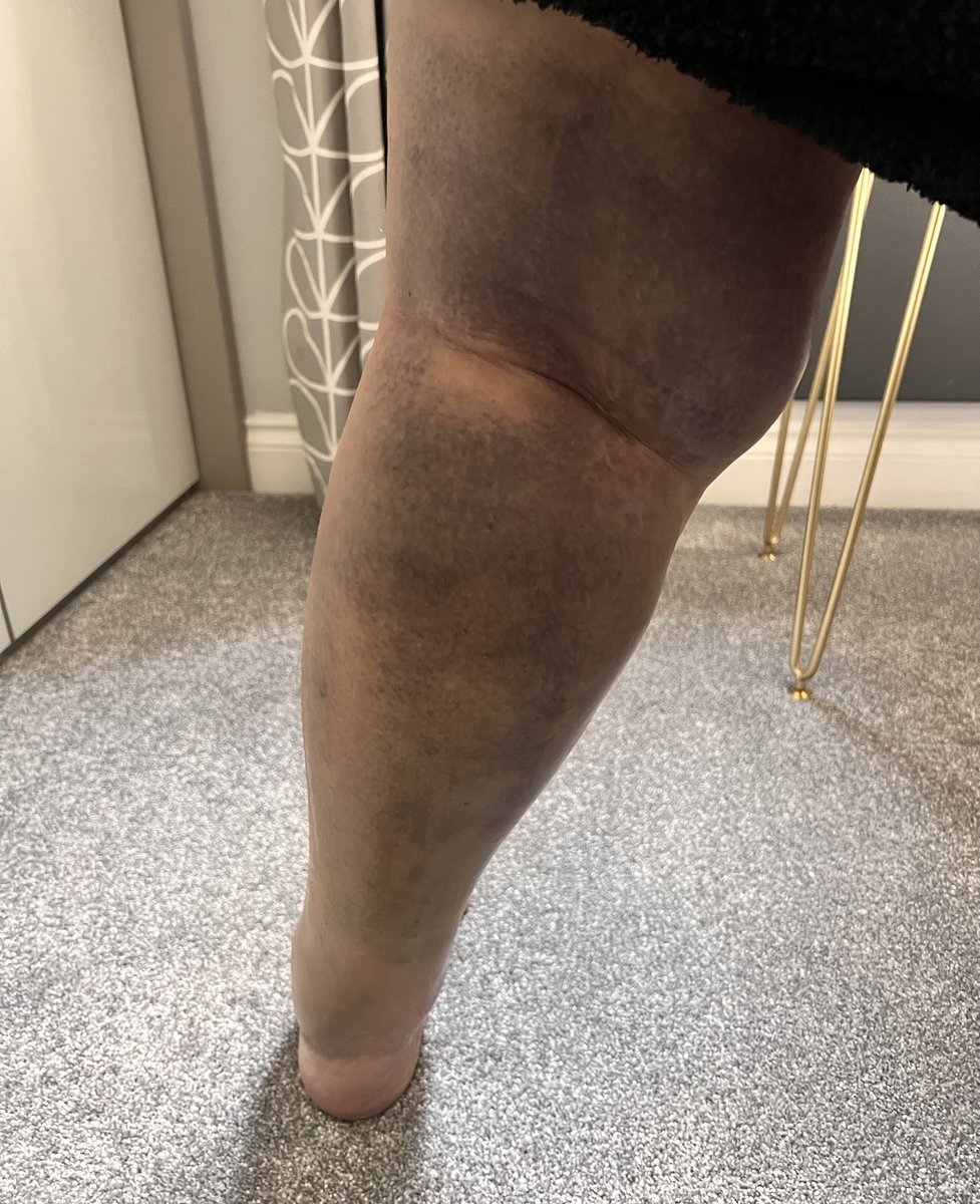 Mr Lumpy & Friends tweet media