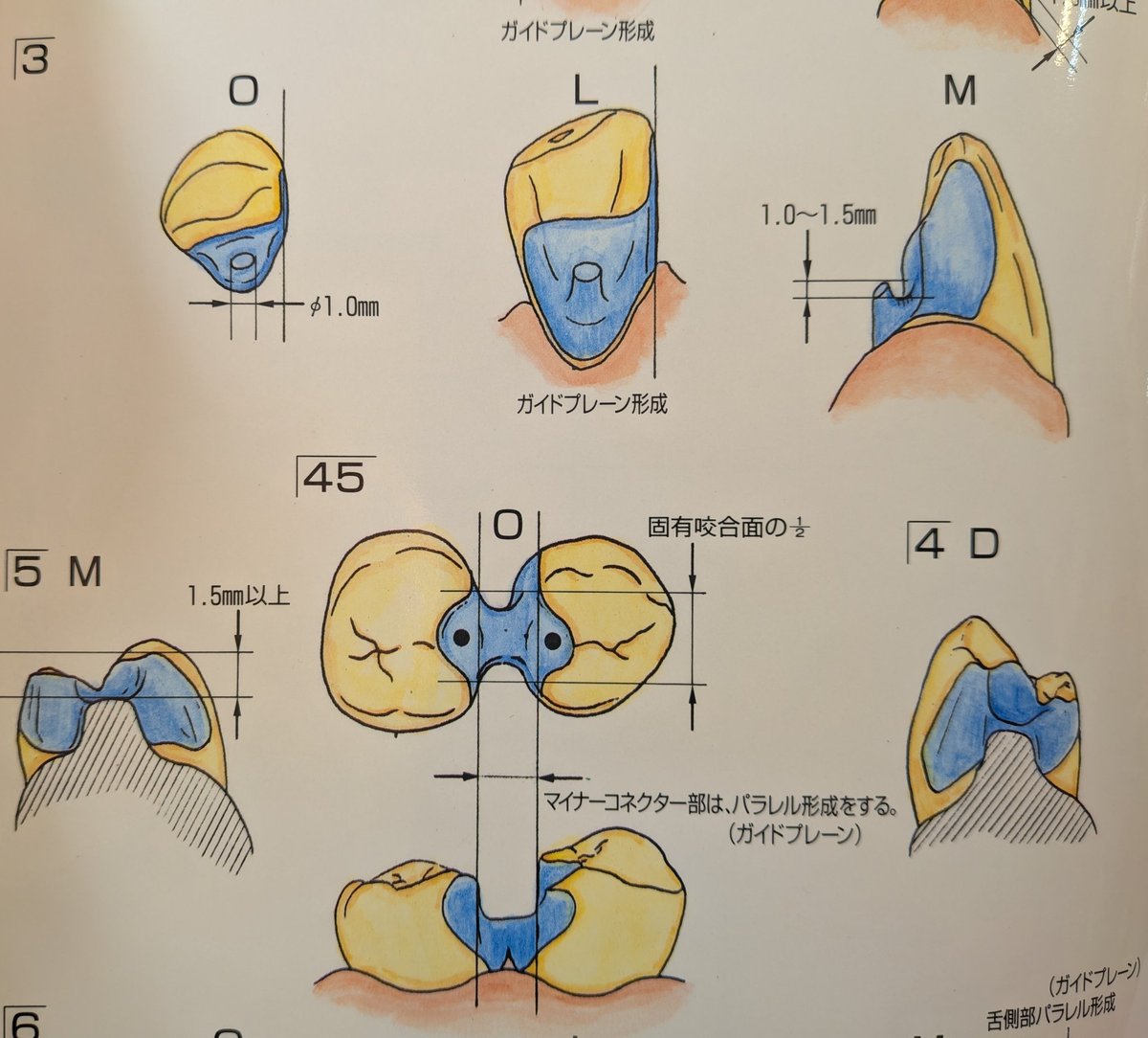 l0kIwa2's tweet photo. 山越えのレストをどう形成したら良いかって質問が来た。いつもこれを送ってる。 https://t.co/BY9U2A7pU1