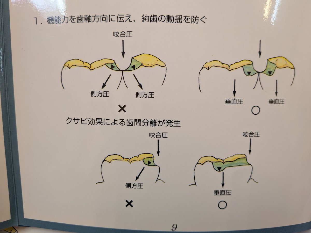 l0kIwa2's tweet photo. 山越えのレストをどう形成したら良いかって質問が来た。いつもこれを送ってる。 https://t.co/BY9U2A7pU1