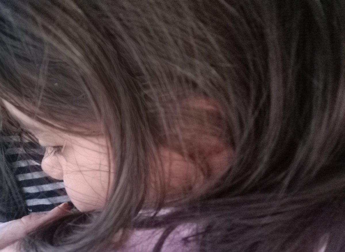 ElifKAN58491181's tweet image. Üşüdük 😃yaaaa🫠🩷
Yeter be kış geçsin 🫢😶‍🌫️😂
Gelmeden gitsin 😎
GÜNAYDIN 🫂🇹🇷
#14C
#Masumiyet
#ÇareMitokondrinde
#HiçUnutmaBebeğim