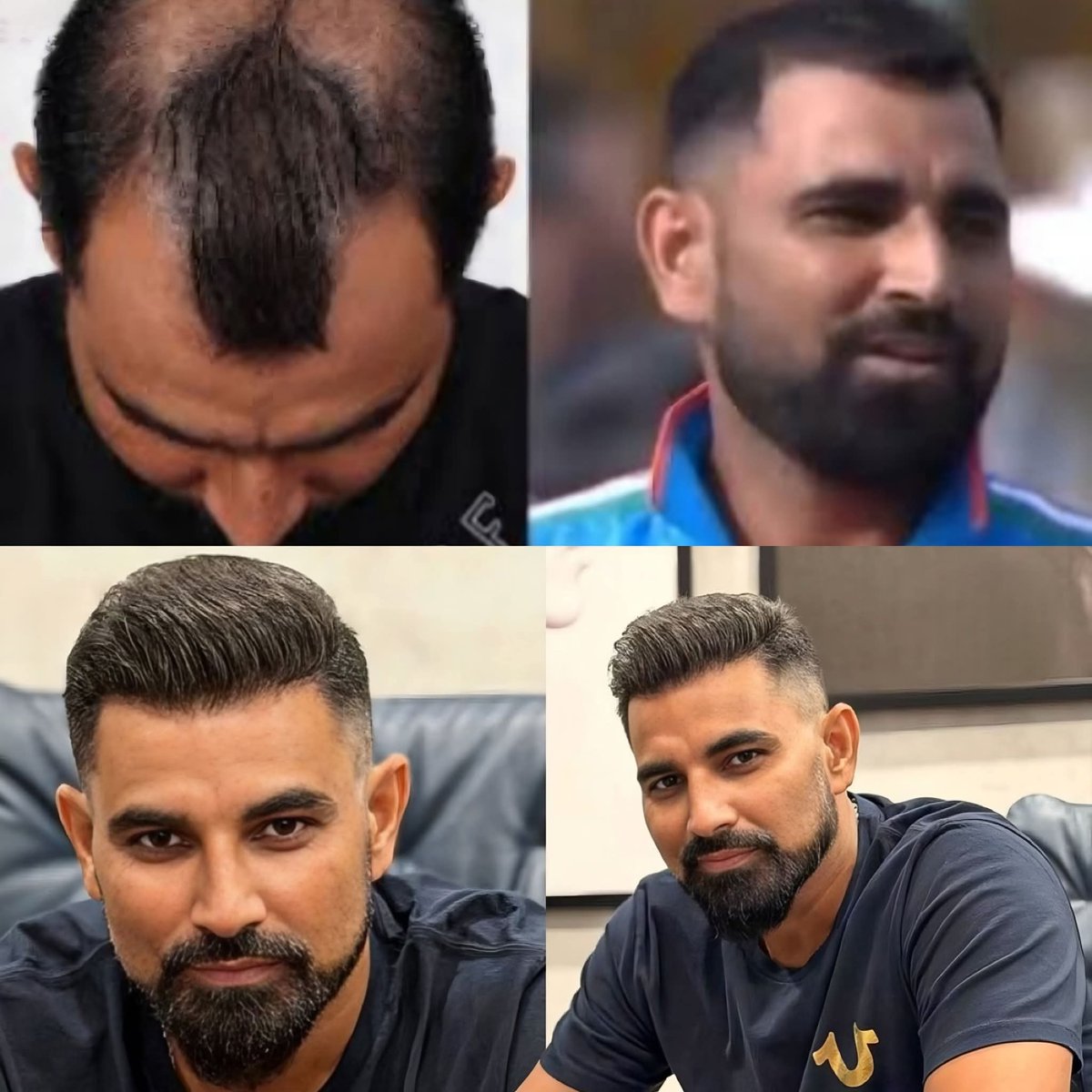 Troll_Cinema's tweet image. Dear Men,

Don&apos;t Stress about the Declining Hairline

Earn Money First, We can FIX.