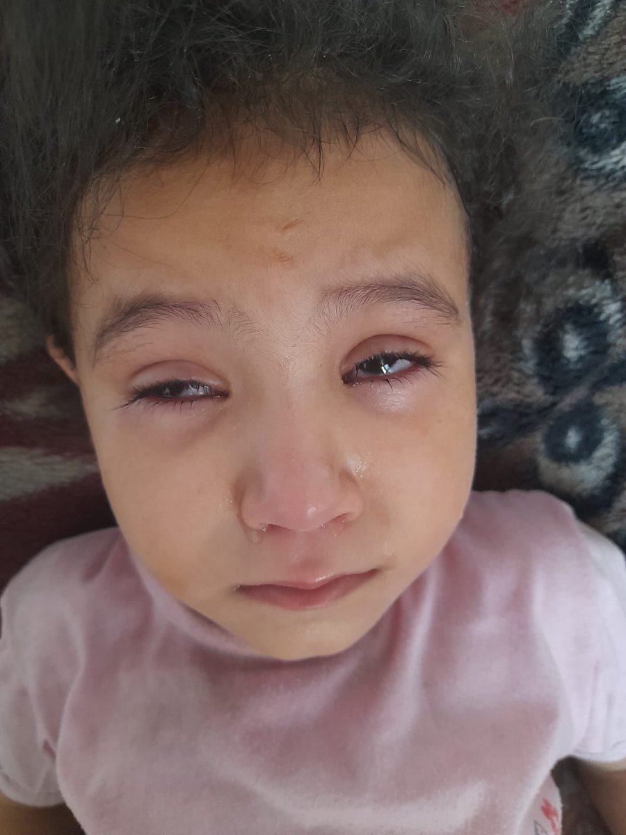 DalulainGaza's tweet image. 😭My little girl, Rosette, is sick and needs treatment and food to recover. I beg you, help me and be the reason my child is saved. She is in pain. Please, I don&apos;t want to lose her. Help me so I can treat and feed her. Please🙏🙏 

chuffed.org/project/138194…