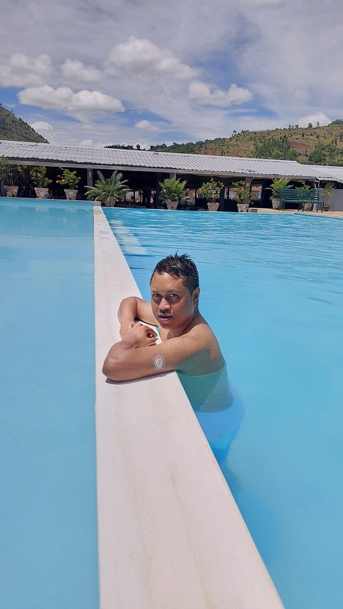 Enjoying the Malagasy 🇲🇬 heat before my friendly Canadian 🇨🇦 cold. 
#SunBeforeSnow #T1D