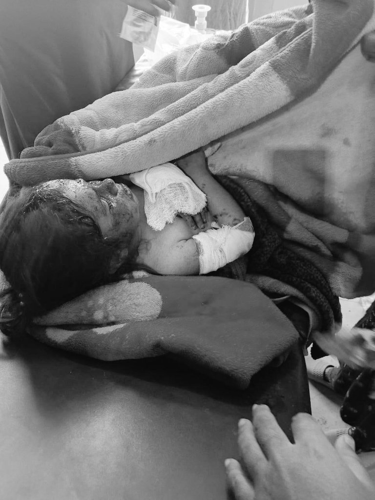 Mohsin_o2's tweet image. Two children were injured when RPG rounds,fired by terrorists belonging to Fitna Al Hindustan, struck a civilian home in Panjgaur.

 The house, belonging to Haji Zafar Khan, was hit in the attack. 

The local administration responded promptly, moving the injured to DHQ Hospital.