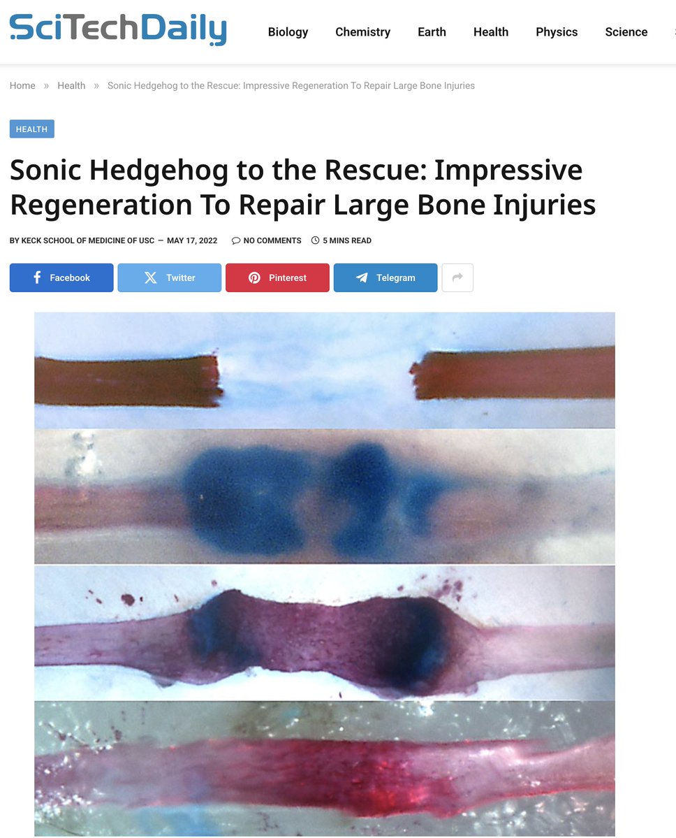 Juanlife4's tweet image. Sonic Hedgehog to the Rescue: Impressive Regeneration To Repair Large Bone Injuries