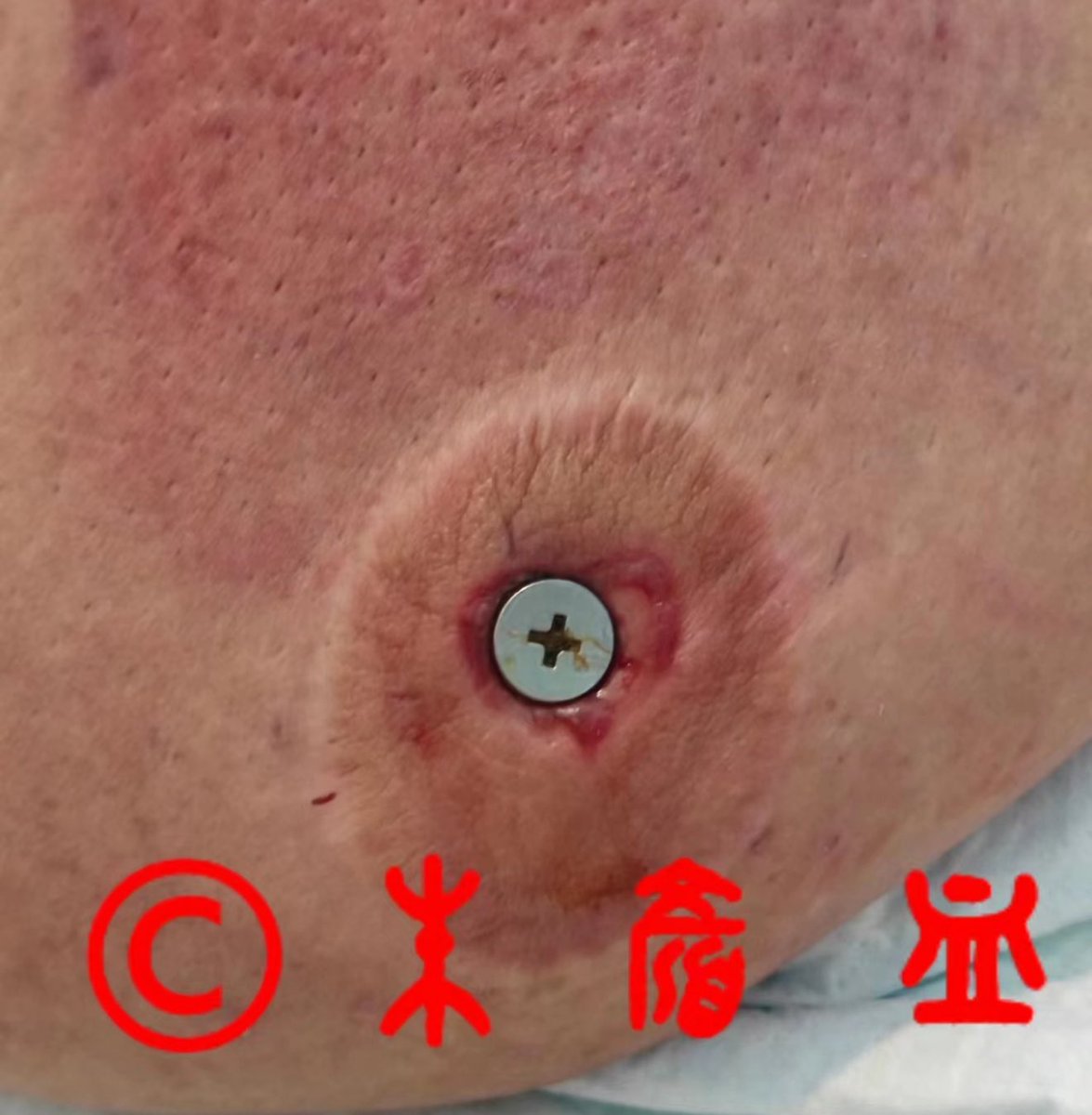 Bloodslave tweet media