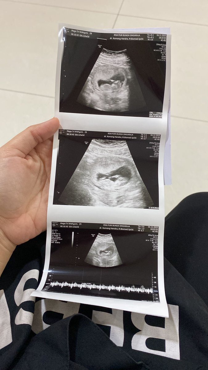 Terimakasih Tuhanku ❤️

Semoga sehat selalu😊
Setelah penantian 3 Tahun ini, engkau berikan sebuah keajaiban untuk kami berdua. 
Untuk kamu yang Ajik sama Ibu sayangi, siapapun kamu 🙏
1. I Gusti Bagus Lintang Panji Sekala Bumi
2. Gusti Ayu Binar Bulan Kamala Renjana 
Sehat2 ya❤️