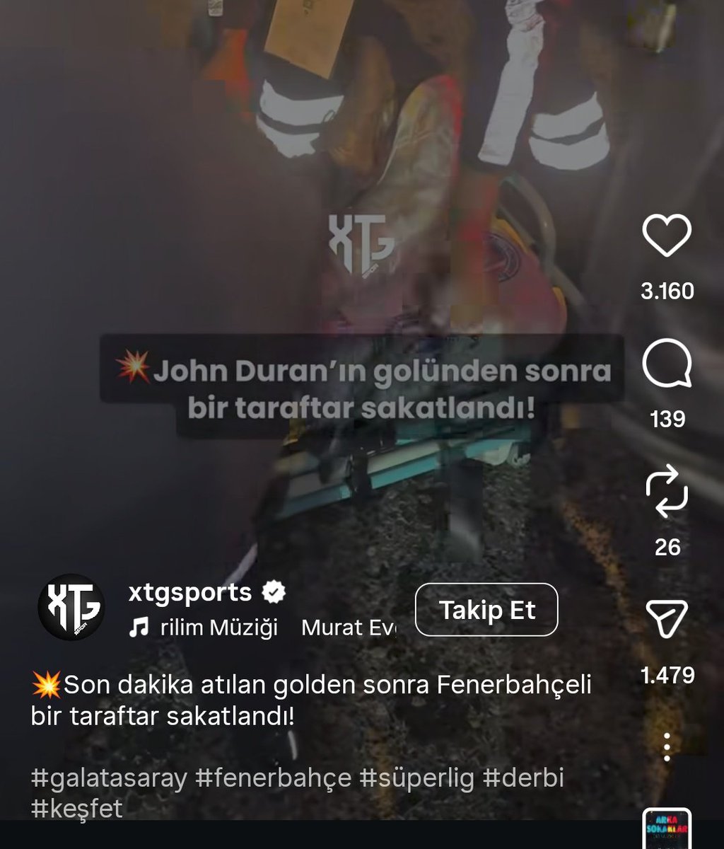 Jhon sakatlanmasın onun yerine ben bacağımı feda ederim demiş ahhhh cefakar taraftarım