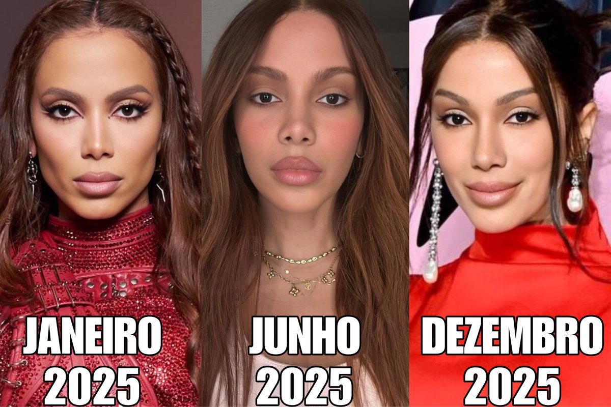 UrachSemGrife's tweet image. anitta tá ficando irreconhecível e o que me pega mais é que em janeiro/26 possivelmente teremos outro rosto