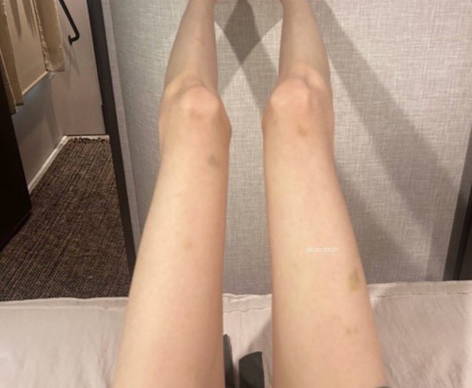 fainthunger's tweet image. #edtwt