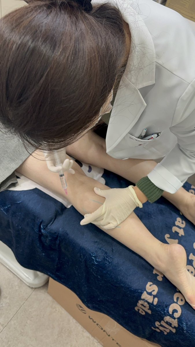 wild_ladies's tweet photo. ohvelyjoo clinic弘大店で
ふくらはぎ🦵ボトックスを受けたよ

私は足が太く…
300U入れてもらったよ🥹

手際がよくあっという間に終わりました
終わった後も丁寧なケアをして頂き
全然痛くなかったよー

結果が楽しみだな🥰 https://t.co/p8BdfSZ06h
