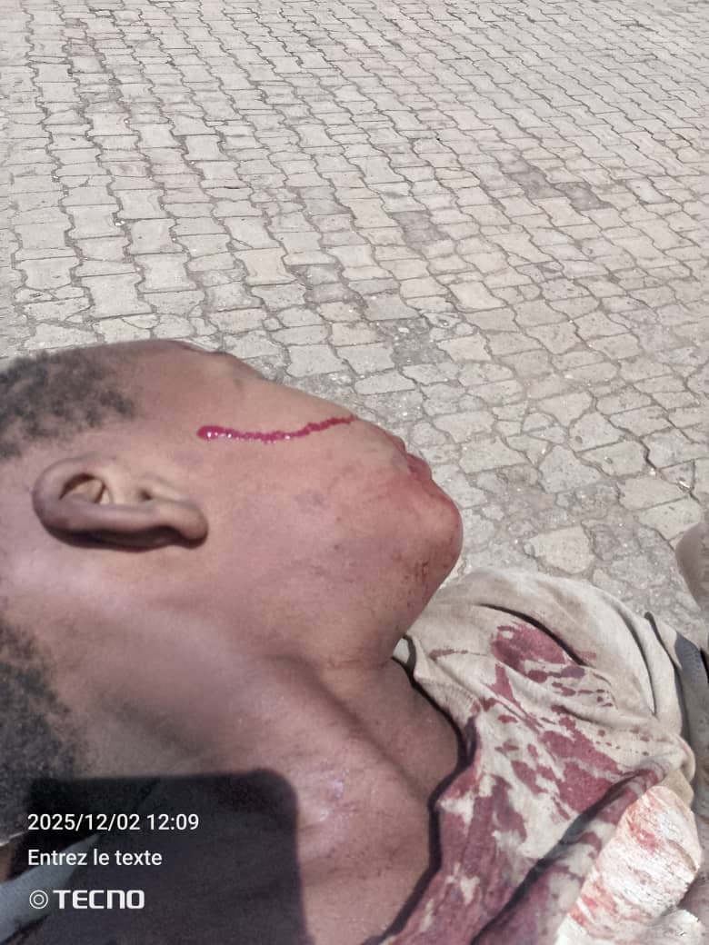 JustinNsengima's tweet image. 2 December 2025, 2:00 p.m. Update

The bombs dropped this Tuesday, 2 December 2025, by the coalition forces of the Kinshasa regime struck the densely populated area of Kamanyola.
Provisional toll: 3 civilians killed and 5 injured, including 1 man, 1 woman, and 3 children.…