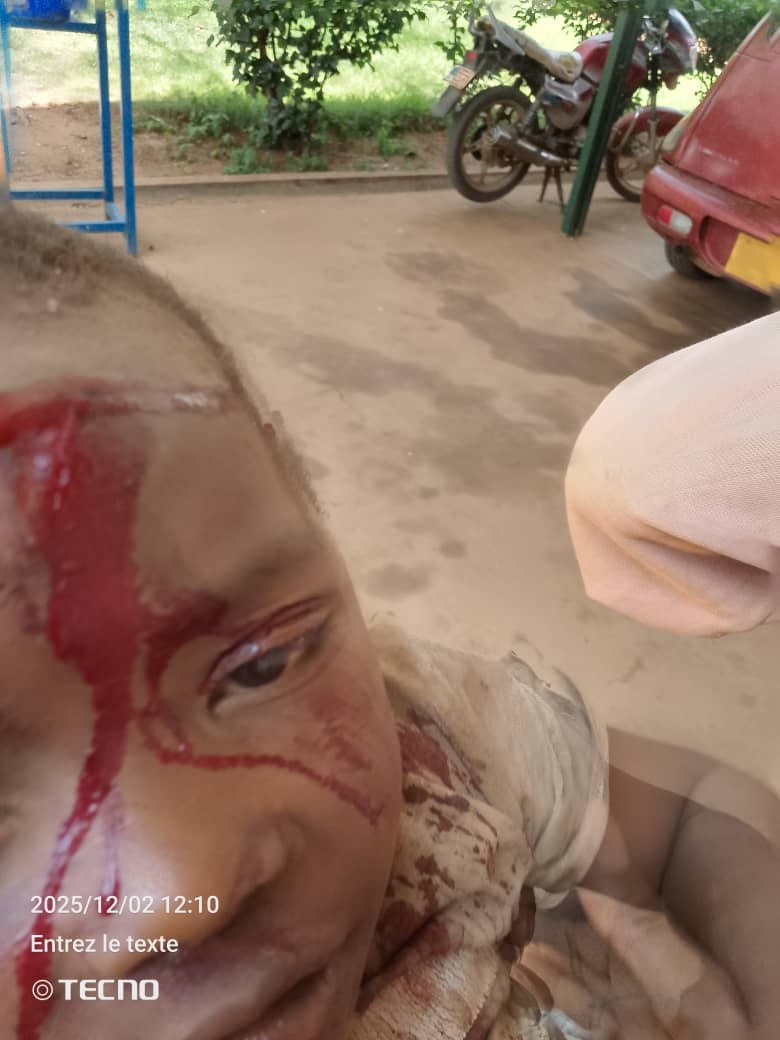 JustinNsengima's tweet image. 2 December 2025, 2:00 p.m. Update

The bombs dropped this Tuesday, 2 December 2025, by the coalition forces of the Kinshasa regime struck the densely populated area of Kamanyola.
Provisional toll: 3 civilians killed and 5 injured, including 1 man, 1 woman, and 3 children.…