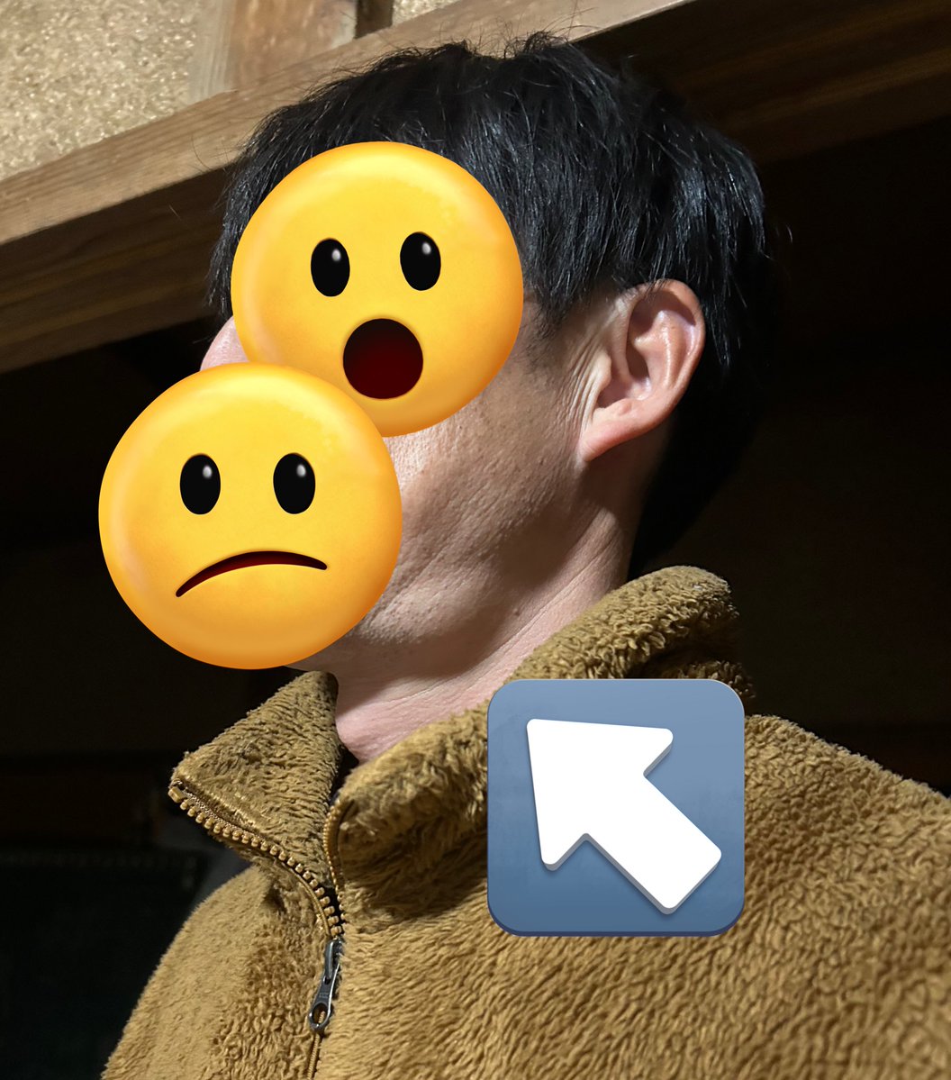 旦那さんの唾液腺炎
こっち側だけ、ふくらんでる。。