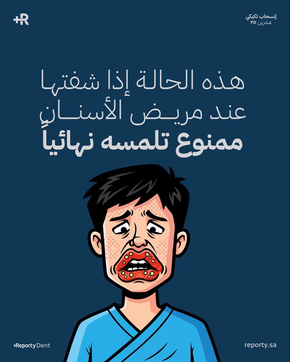أحياناً يدخل عليك المراجع بألم، أو تورّم بسيط حول الشفايف 👄

وأنت على طول تفكر: “يمكن التهاب؟ يمكن حساسية؟ 💢 

لكن لو شفت small Vesicles + إحمرار + حرقان هذه غالباً Herpes Labialis، وهنا توقف قبل أي إجراء 🛑

أيش الحاصل بالضبط ؟ 👁️‍🗨️🔍

فيروس الـ Herpes Simplex (HSV-1) ينشط