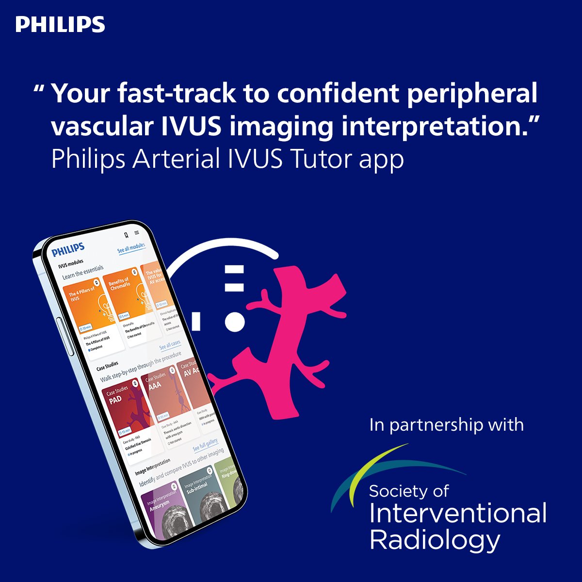 Philips Peripheral Vascular Interventions tweet media