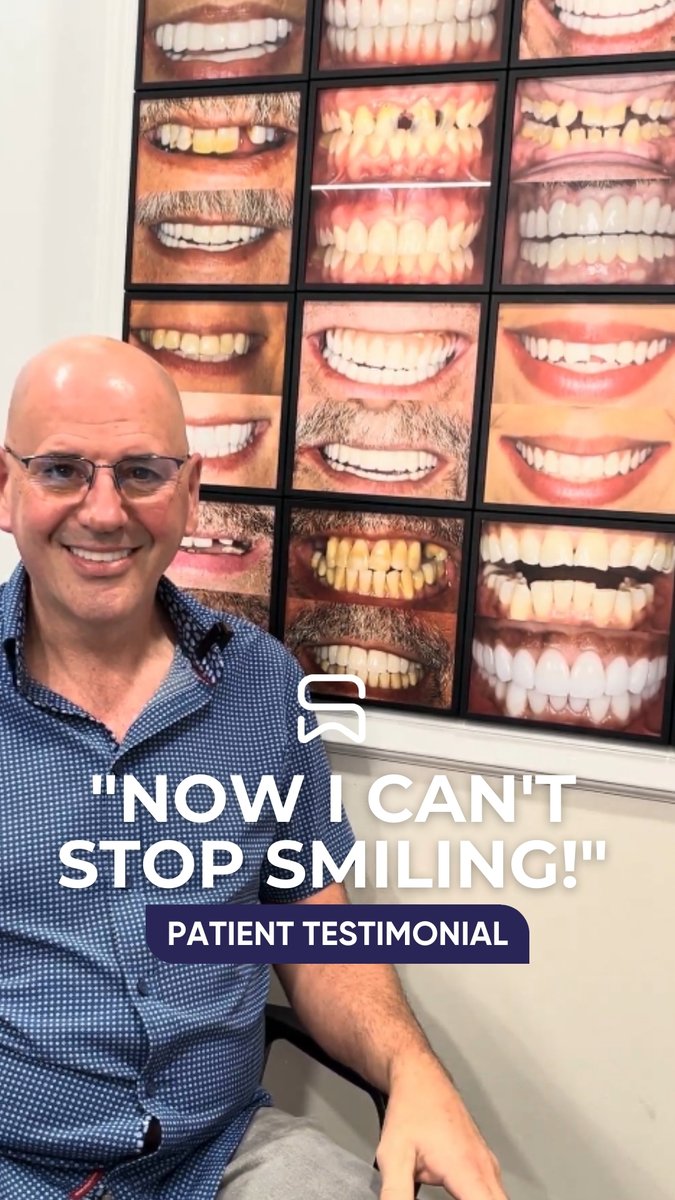 SDGDental's tweet image. Meet one of our incredible patients who recently came back to Signature Dental Group after 15 long years away from the dentist. He came in with a cracked tooth, needing a root canal.

#ComfortableDentistry #CrackedTooth #RootCanal #Dentistry #DentalCare