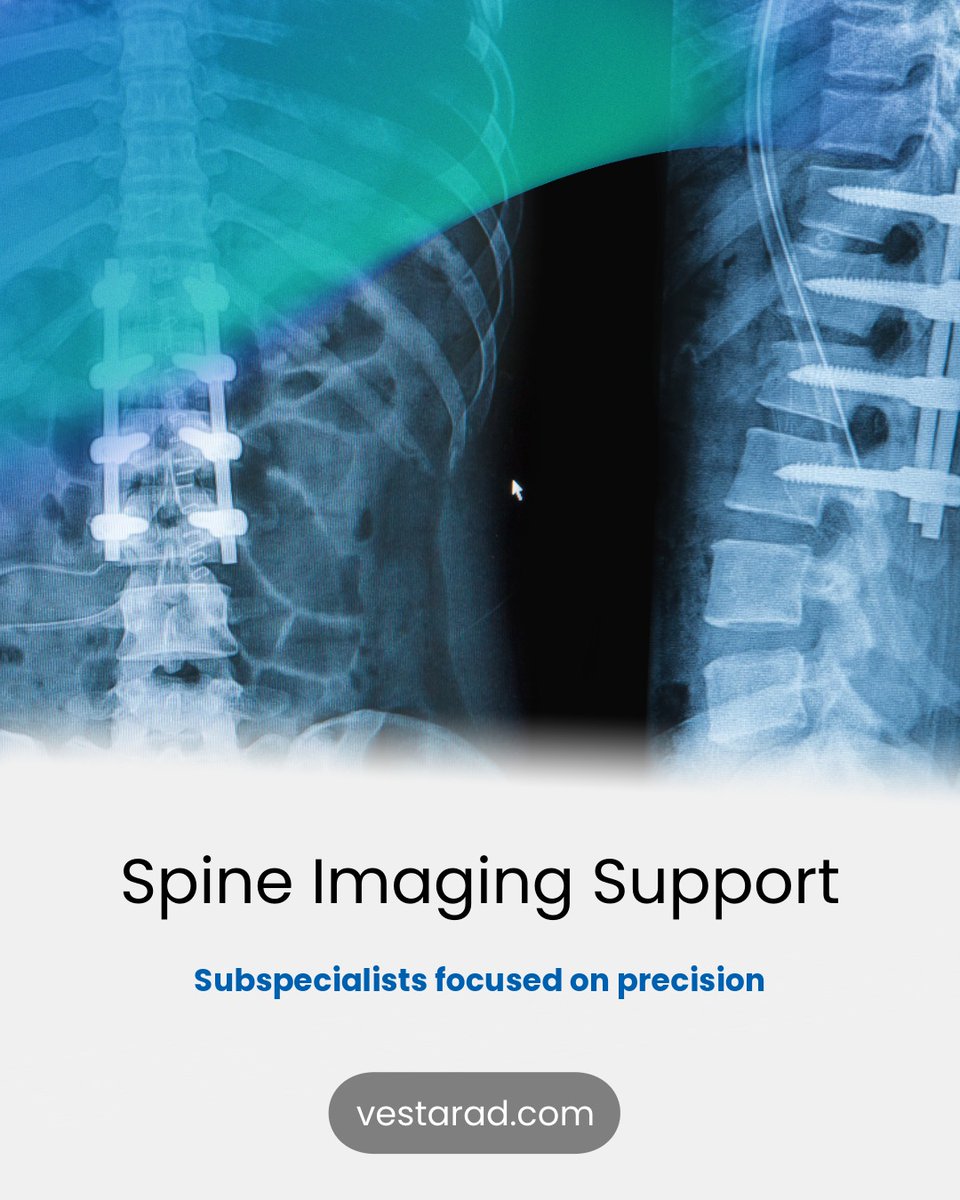 vestarad's tweet image. Spinal pathology needs expert reads. Vesta’s radiologists provide accurate, timely interpretations for back pain, trauma, and surgical follow-up. #SpineImaging #Neuroradiology