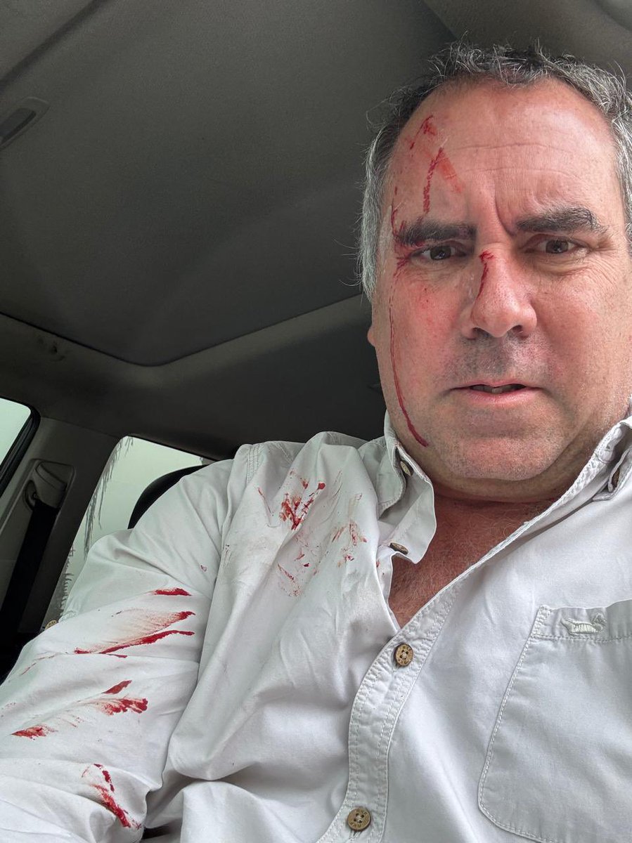 CostaGino's tweet photo. Grave atentado contra la vida de Rafael Belaunde, candidato presidencial de Libertad Popular. Investigaciones deben dar con el móvil del crimen, y la justicia sancionar rápido y con firmeza a sus responsables. Le toca al gobierno dar las garantías a los postulantes a la presidencia y detener la violencia electoral YA!