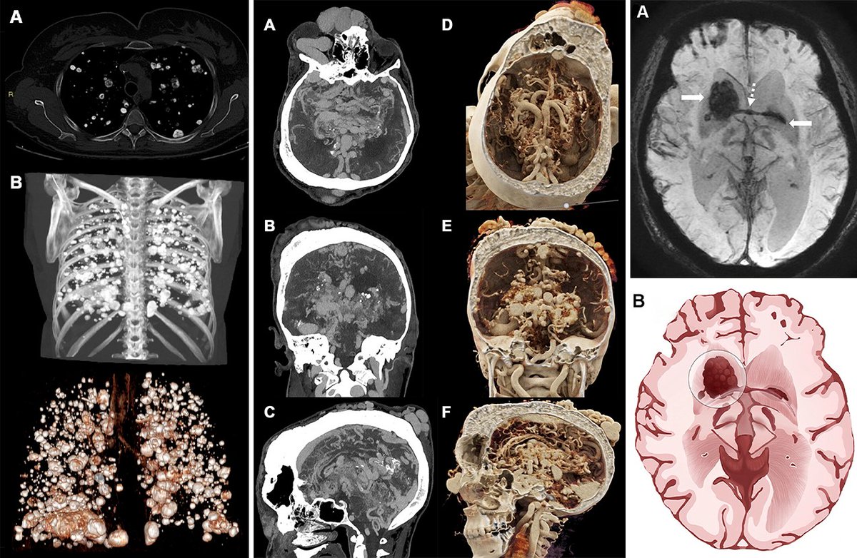 radiology_rsna's tweet photo. Congratulations to the 2025 “Top Images in Radiology” winners! Check out these remarkable images selected by the #RadInTraining editors. @AdarshGhost @SL_Radiology @RITEditor https://t.co/ukHHeEbz9y
