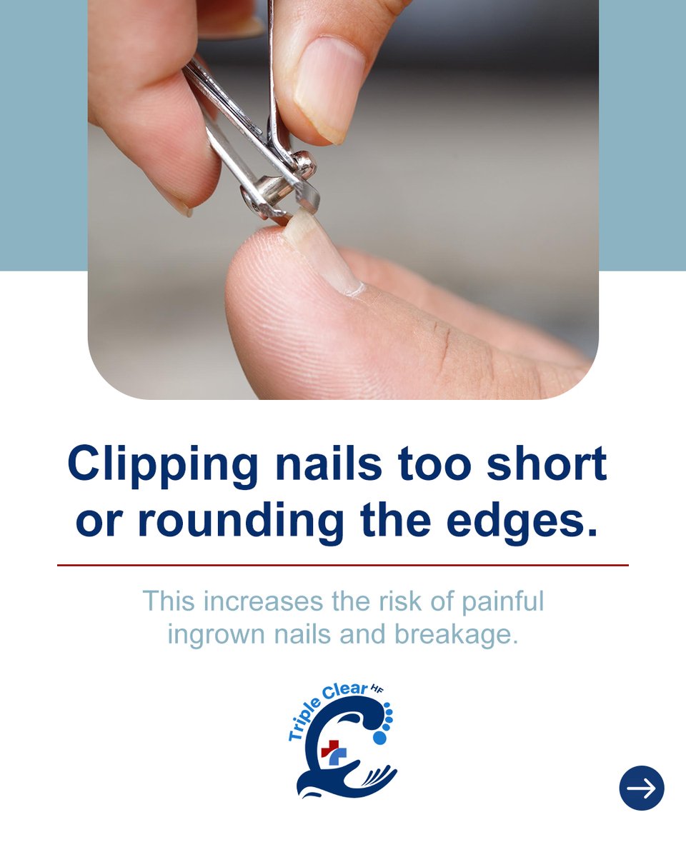TripleClearHF's tweet image. Small nail care mistakes can cause infection or damage.

From short cuts to ignored discoloration, details matter.

Protect and strengthen with Triple Clear HF. DM us to order!

#NailHealth #NailHygiene #TripleClearHF