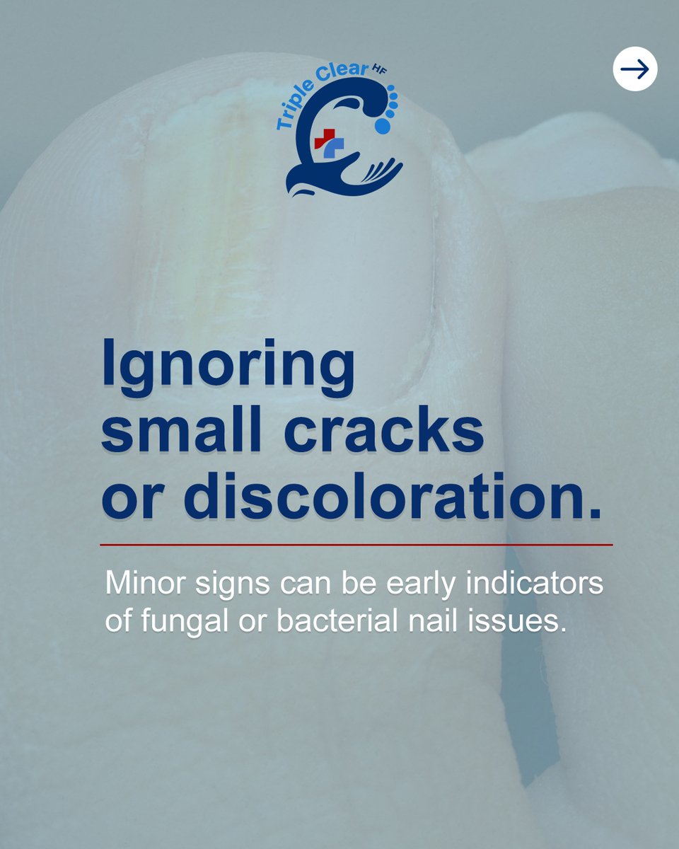 TripleClearHF's tweet image. Small nail care mistakes can cause infection or damage.

From short cuts to ignored discoloration, details matter.

Protect and strengthen with Triple Clear HF. DM us to order!

#NailHealth #NailHygiene #TripleClearHF