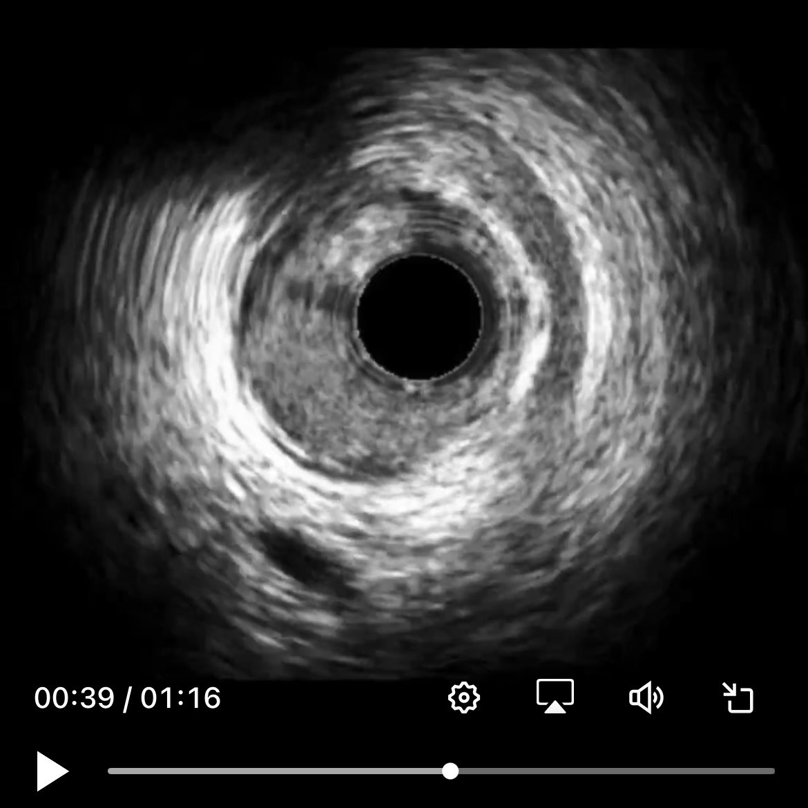 Richard Sohn MD tweet media