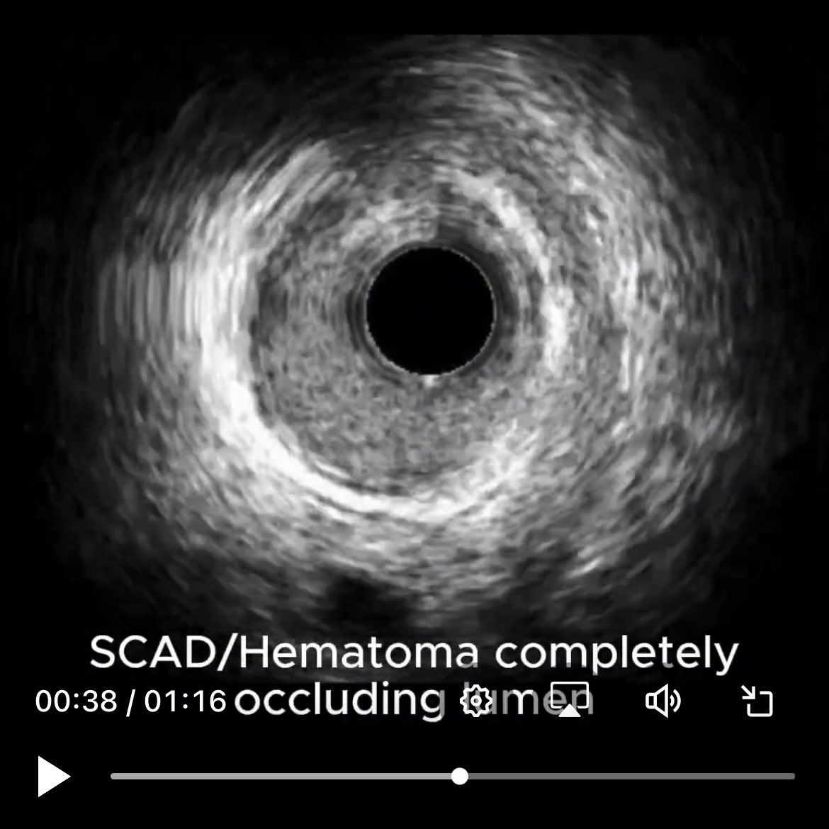 Richard Sohn MD tweet media