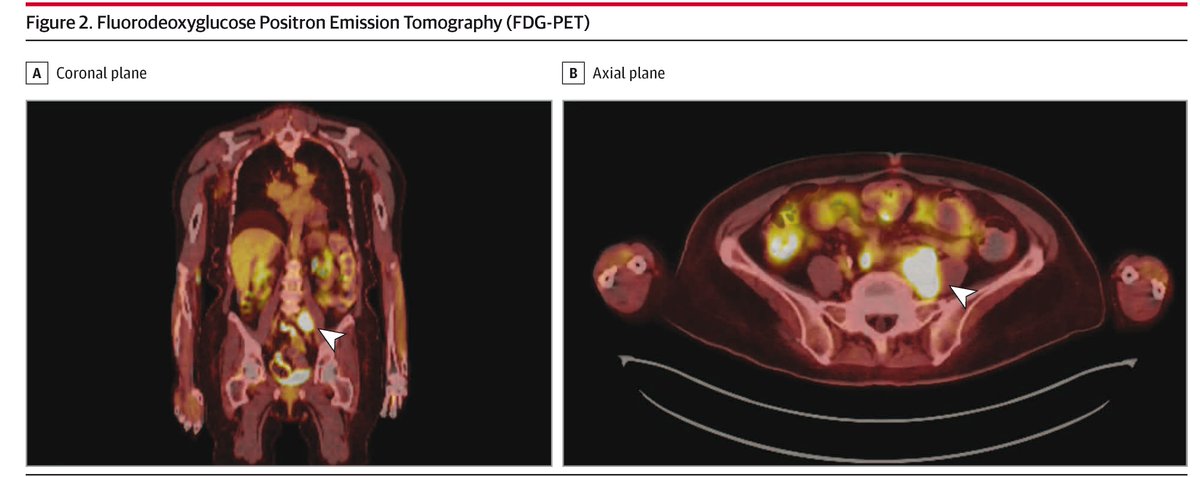 JAMA Neurology tweet media