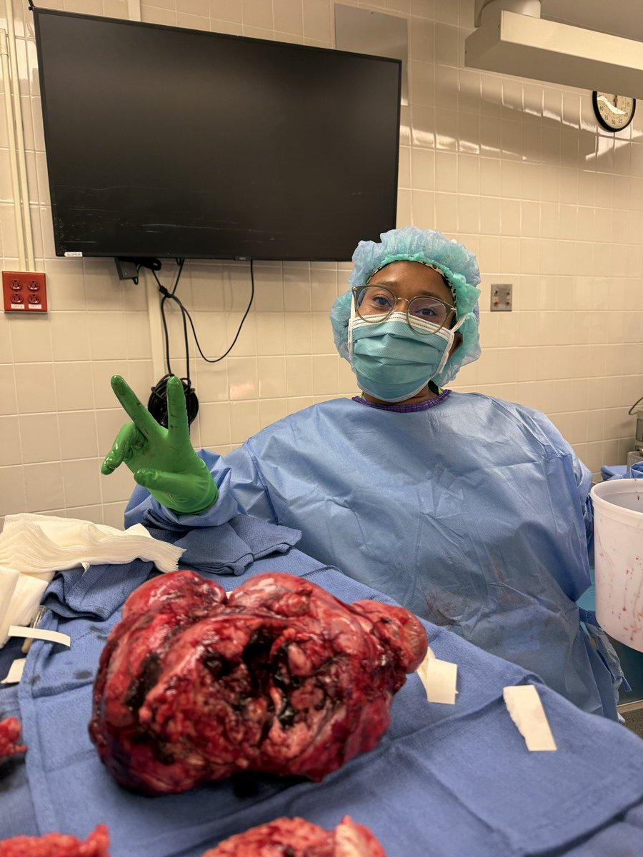 Me being myself on a regular day vs me at work (This is a uterus enlarged by fibroids)