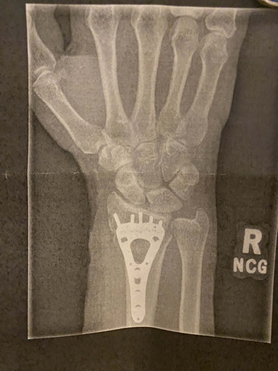 Does anyone have a favorite voice to text software that can handle scientific terms or learn them? 
My right hand is going to be out of action for quite a few months and my computer keeps thinking that iron pyrite is iron pirates and a million other annoyances.